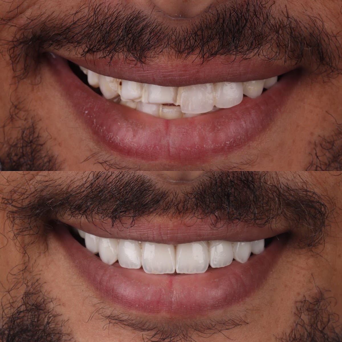 Estia Dental