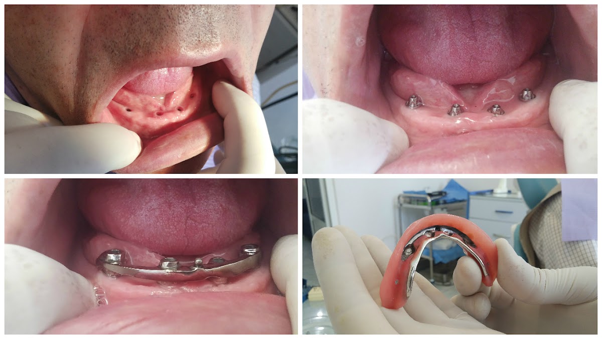 VB Dental Clinic